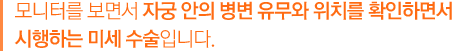 모니터를 보면서 자궁 안의 병변 유무와 위치를 확인하면서 시행하는 미세 수술입니다.